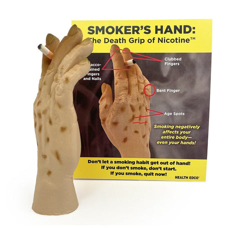 Smoker’s Hand: Smoking Awareness Hand Model – BIOLIKE™-Teaching Aids-Birth Supplies Canada
