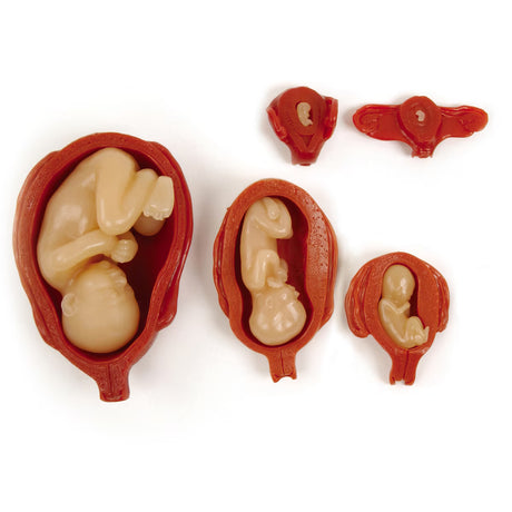 Uterus/Fetus Model Set (5) – BIOLIKE 2™ Teaching Models-Teaching Aids-Birth Supplies Canada