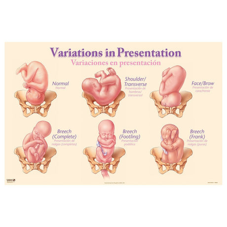 Variations in Presentation Chart – Laminated Bilingual-Teaching Aids-Birth Supplies Canada