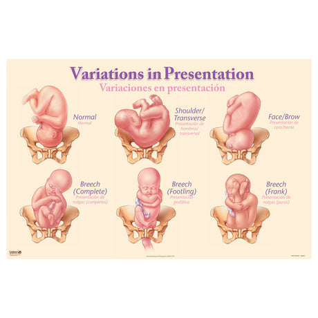 Variations in Presentation Chart-Teaching Aids-Birth Supplies Canada